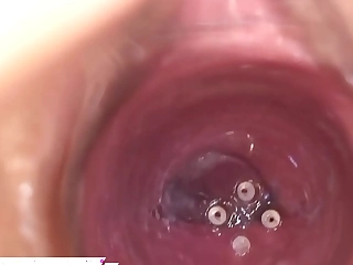 阴道内的摄像头